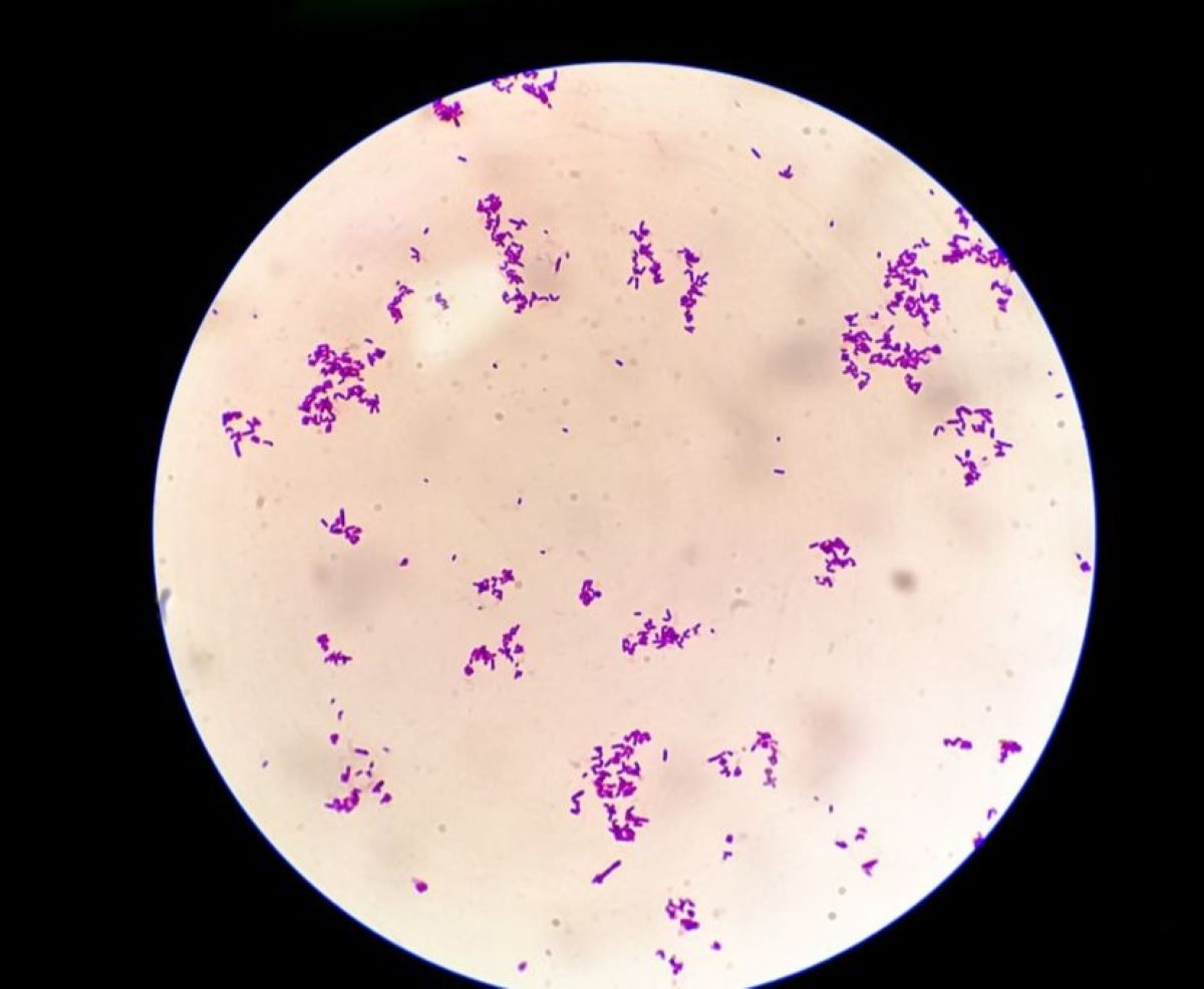 Streptococcus pyogenes